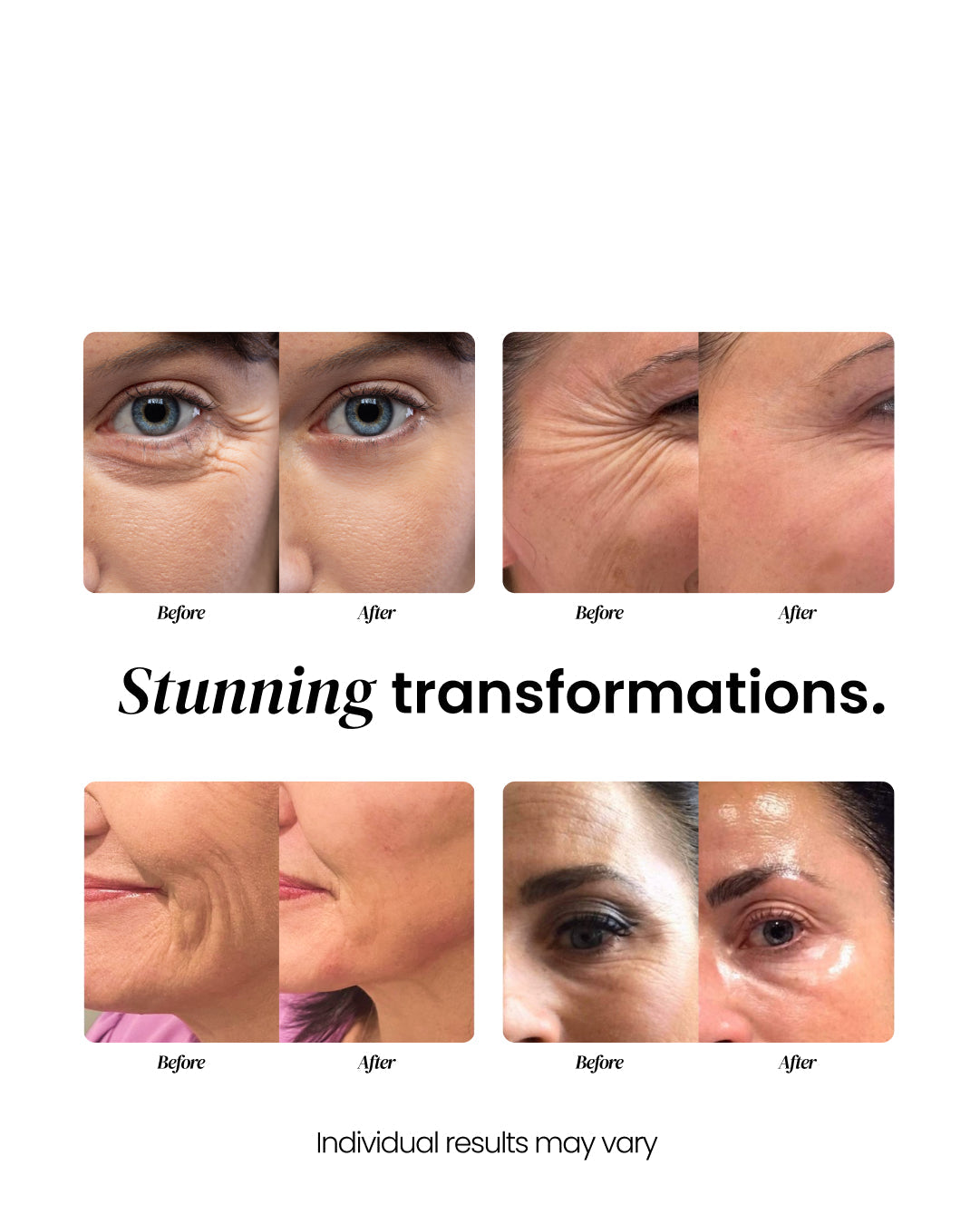 Aging Repair Cream