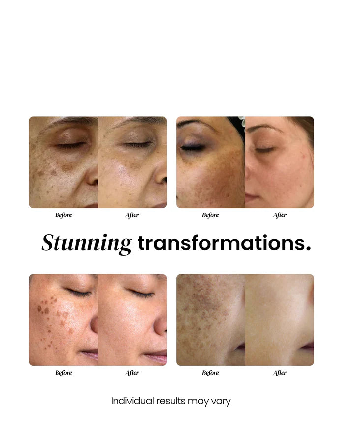 Dark Spot Corrector