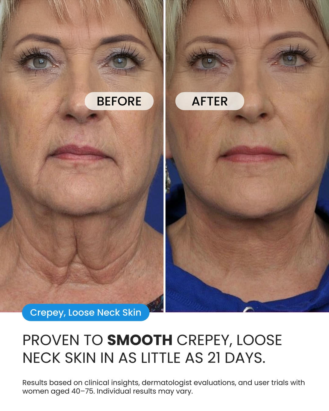 Neck Cream
